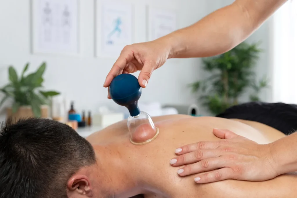 terapia alternativa, aplicación de ventosas de fuego